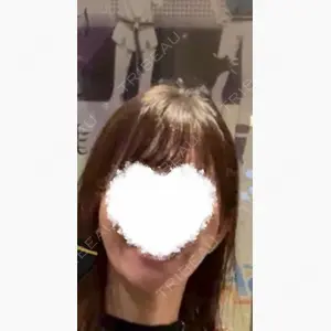 東京ココセランクリニック口コミ