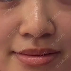 アリエル美容クリニック 大宮院口コミ