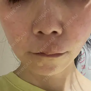 吉祥寺アイビークリニック口コミ