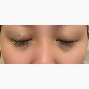 吉祥寺アイビークリニック口コミ