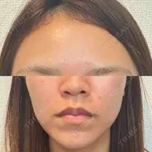 ルラ美容クリニック 静岡院口コミ