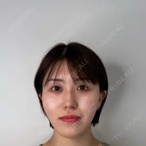 BON BON CLINIC 銀座駅前本院口コミ