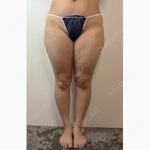 GAYA body design clinic口コミ