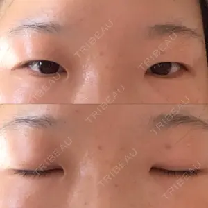 銀座みゆき通り美容外科 大阪梅田院口コミ