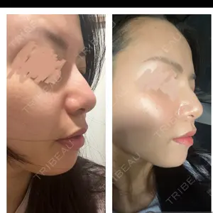 GAYA body design clinic口コミ