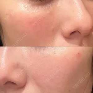 麻布台美容皮膚科クリニック口コミ