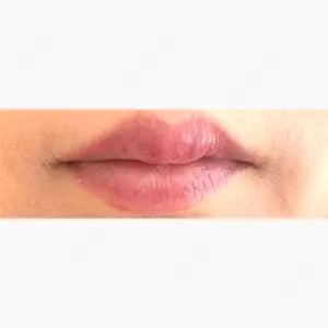 目白ホワイトクリニック口コミ