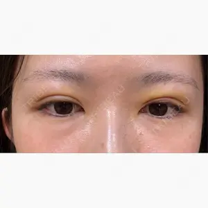 APOLLO BEAUTY CLINIC口コミ