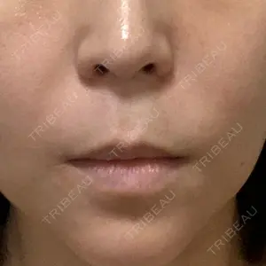 池田クリニック 大阪院口コミ