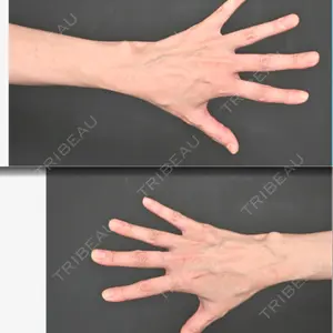 Lipo Clinic omotesando口コミ