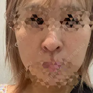 サラン鶴橋皮フ科口コミ