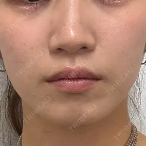 TCB東京中央美容外科 天王寺院口コミ