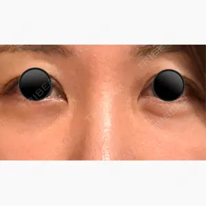 APOLLO BEAUTY CLINIC口コミ