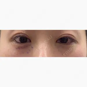 小倉美容外科ネビュラクリニック口コミ