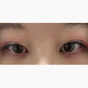 仙台駅前美容外科口コミ