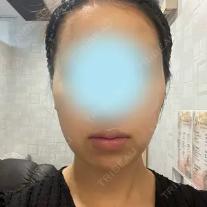 東京ココセランクリニック口コミ