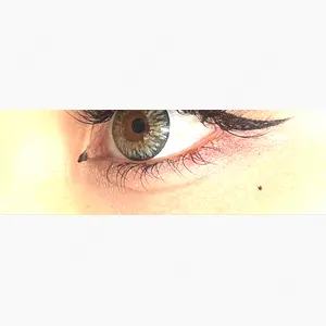 TCB東京中央美容外科 熊本院口コミ