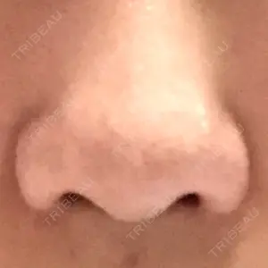 湘南美容クリニック 高松院口コミ