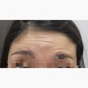 新宿TAクリニック口コミ