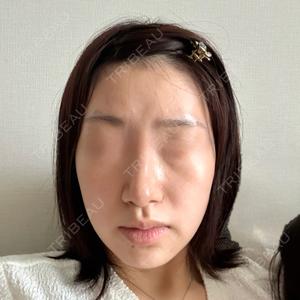 新宿美容外科ネビュラクリニック口コミ