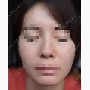 東京ヒルズクリニック 銀座院口コミ