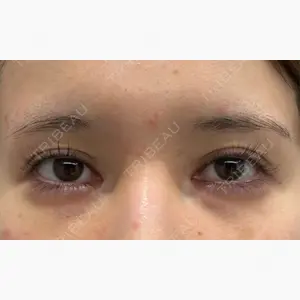 BIANCA銀座口コミ