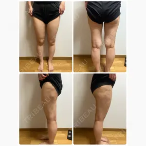 湘南美容クリニック 新橋銀座口院口コミ