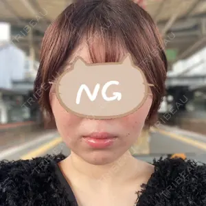 TCB東京中央美容外科 周南徳山駅ビル院口コミ