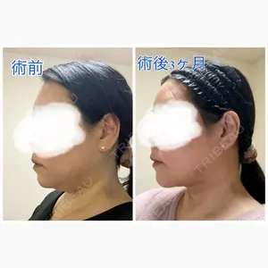 ヴェルトラクリニック 新宿院口コミ