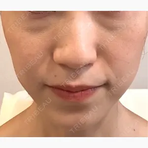 Nクリニック伏見口コミ