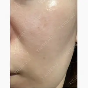 新宿ラクル美容外科クリニック 新宿院口コミ