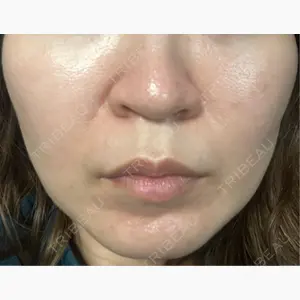 A CLINIC（エークリニック） 横浜院口コミ