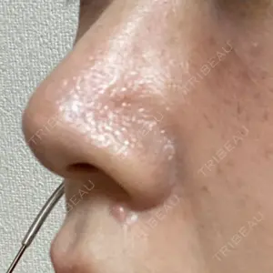 日本美容・医療クリニック 六本木院口コミ