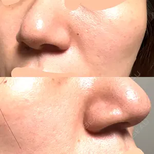 ルラ美容クリニック 仙台院 / ルラスキンクリニック 仙台院口コミ