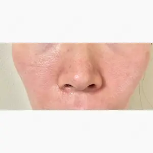 YVESJU CLINIC （イヴジュクリニック） 表参道院口コミ