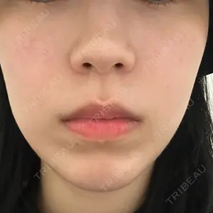 東京美容外科 札幌院口コミ