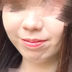 Code Beauty Clinic 名古屋院口コミ