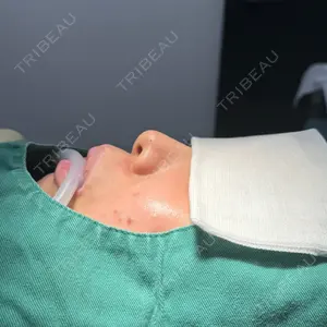 ネビュラクリニック 京都院口コミ