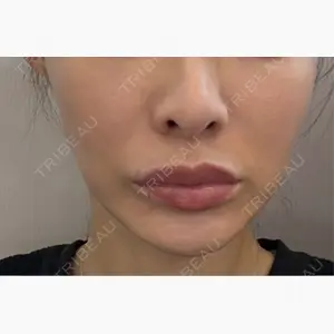 PRISM Beauty Clinic口コミ