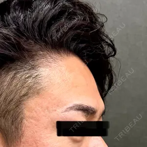 ネビュラクリニック 京都院口コミ