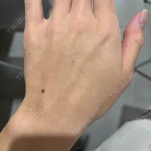 新宿Ladies&Gentlemen美容クリニック口コミ
