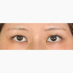 アリエル美容クリニック 郡山院口コミ