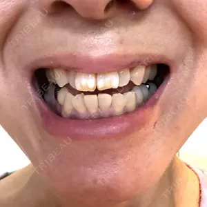 A CLINIC（エークリニック） デンタル 銀座口コミ