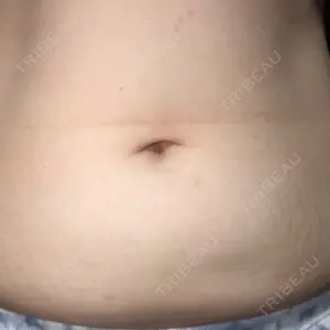 品川美容外科 札幌院口コミ