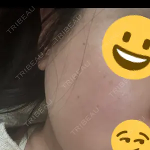 BAO CLINIC 梅田院口コミ