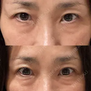 銀座みゆき通り美容外科 大阪梅田院口コミ