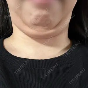 ヴェルトラクリニック 新宿院口コミ