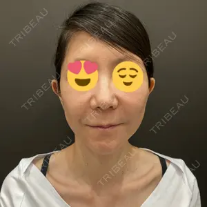 YBC横浜美容外科 池袋院口コミ