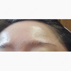 A CLINIC（エークリニック） 仙台院口コミ