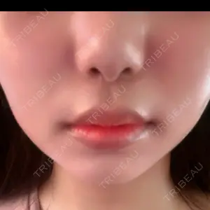 共立美容外科 福岡院口コミ